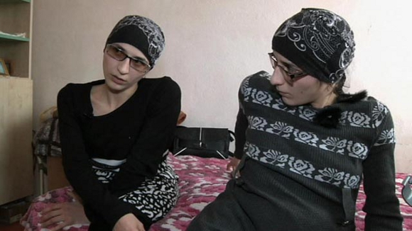 Разделенные сиамские близнецы Зита и Гита Резахановы. Источник фото: http://www.1tv.ru/sprojects_edition/si5685/fi22085